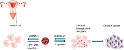 Molecular Mechanisms of HIV Protease Inhibitors Against HPV-Associated Cervical Cancer: Restoration of TP53 Tumour Suppressor Activities